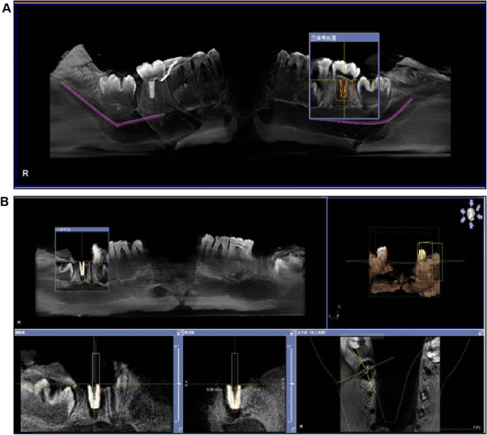 Fig. 3