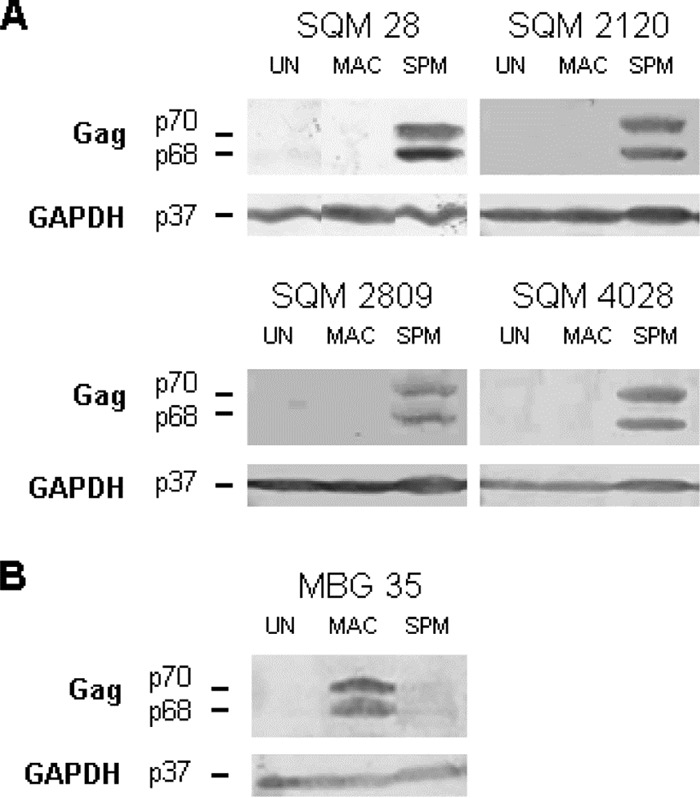 FIG 1