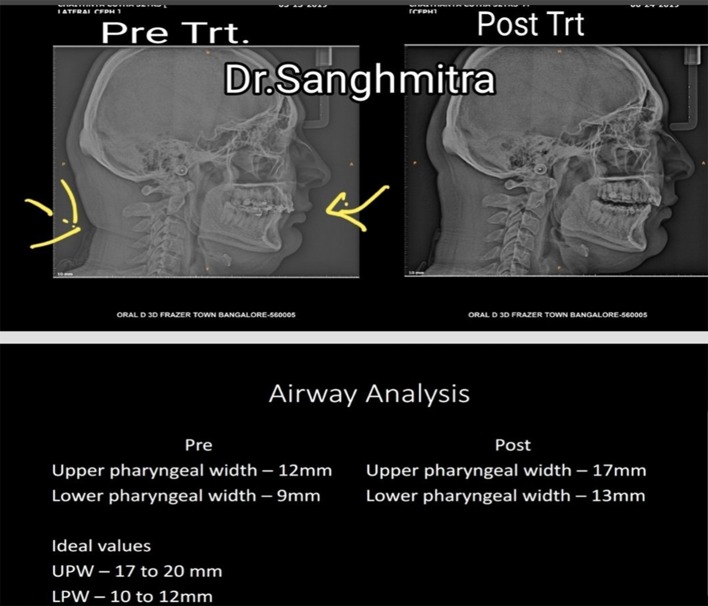 Fig. 9