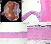 Fig. 11