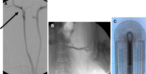 Fig. 2