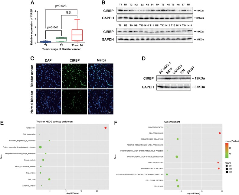 CIRBP is a novel oncogene in human bladder cancer inducing expression ...