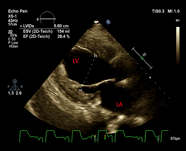 Figure 2.