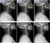 Fig. 6