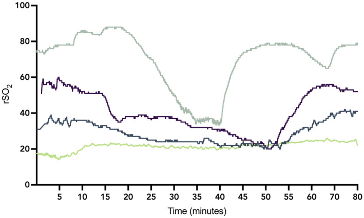 FIGURE 2