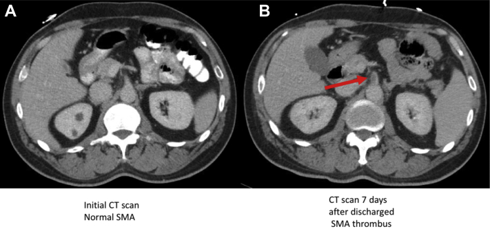 Fig 1