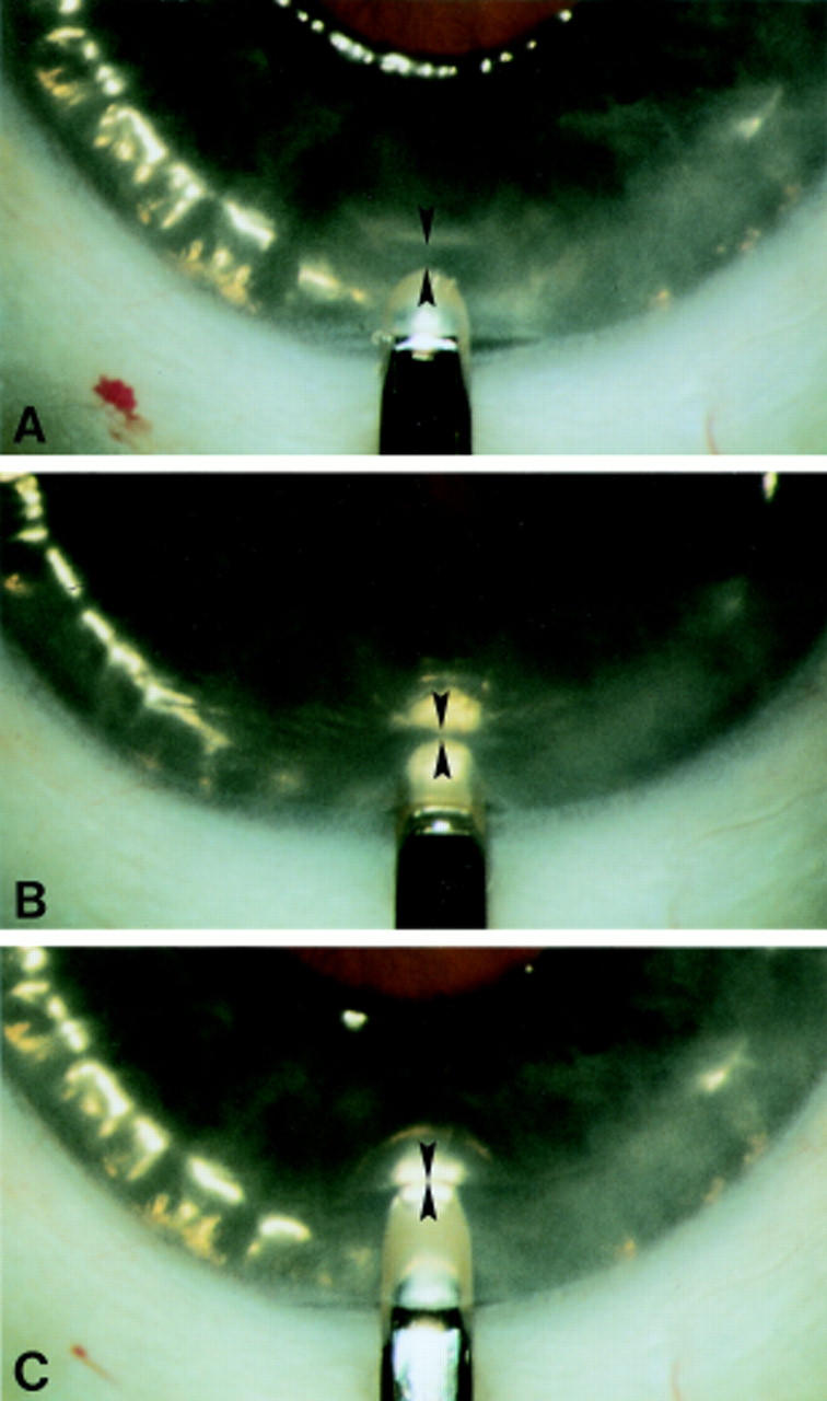 Figure 2  