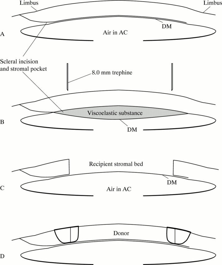 Figure 1  