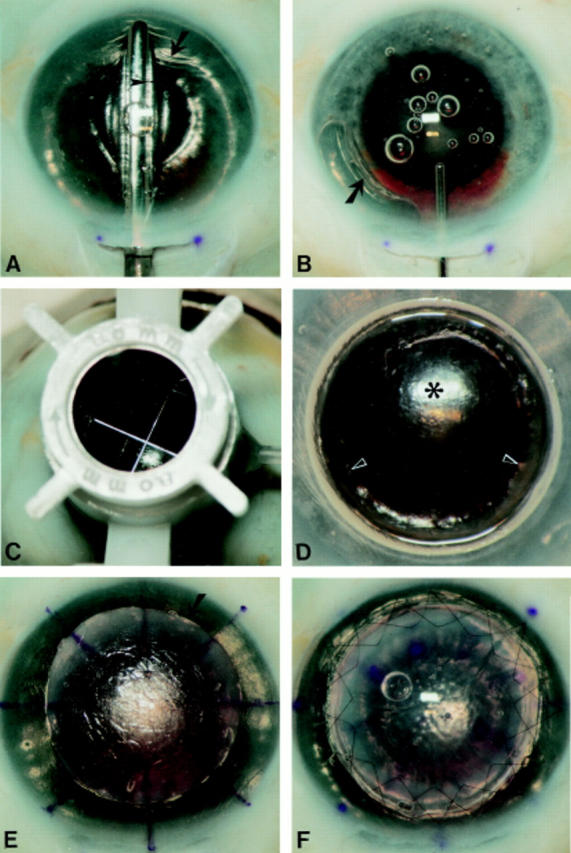 Figure 3  