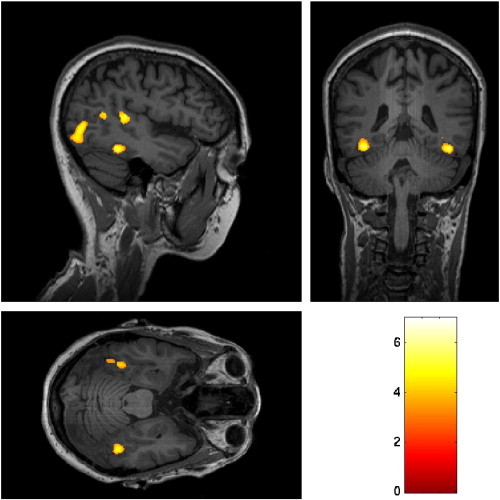 Fig. 4