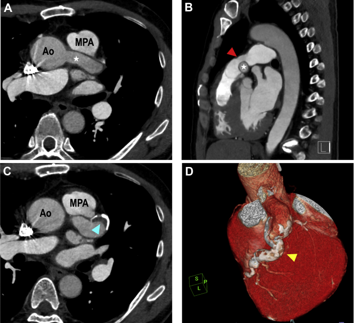 Figure 3