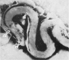 226-1