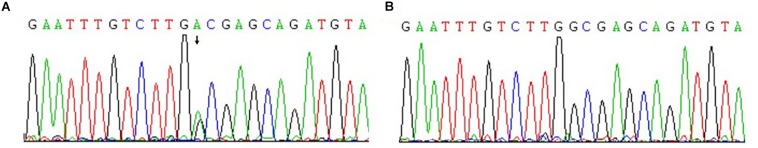 FIGURE 3