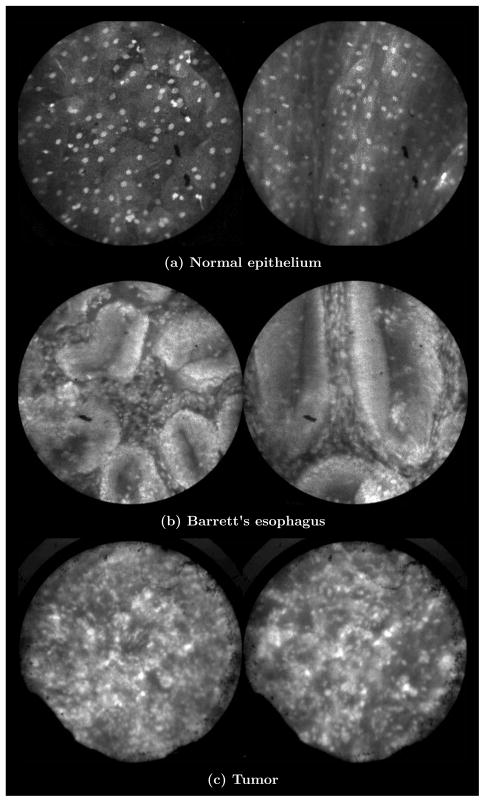 Fig. 17