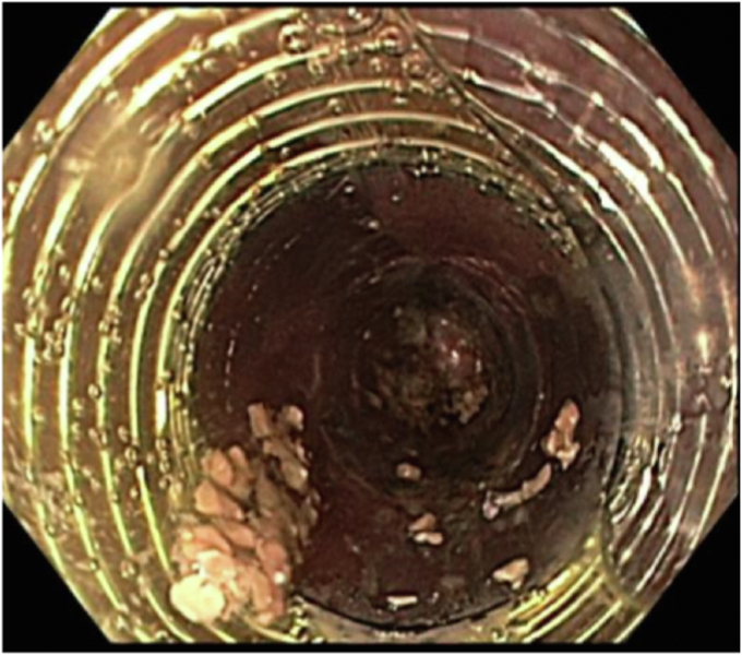 Figure 3