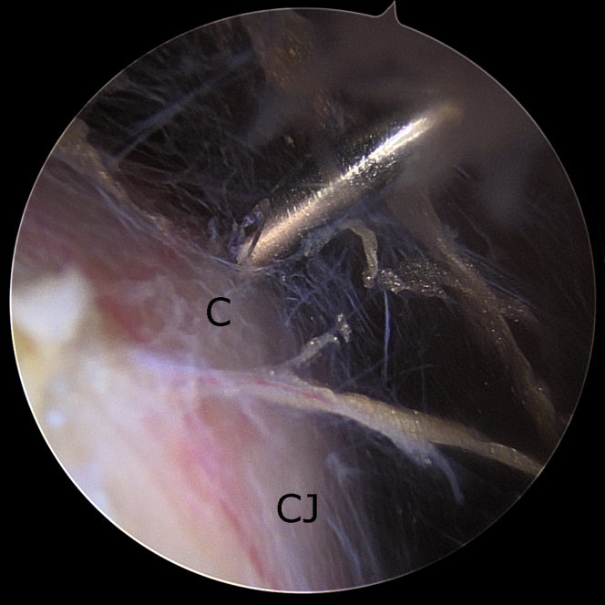 Figure 4