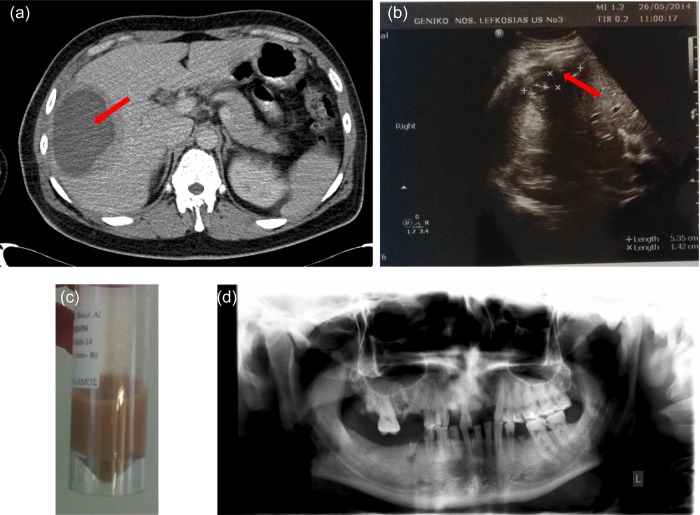 Figure 1: