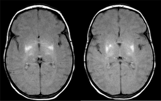 Figure 4e: