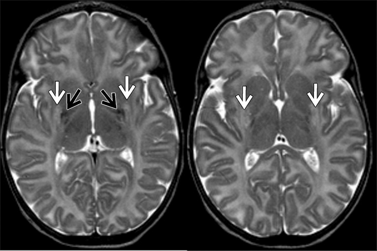 Figure 4d: