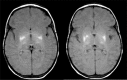 Figure 4e: