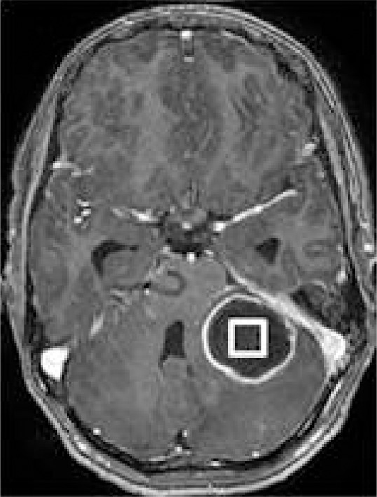 Figure 7d: