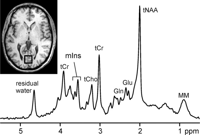 Figure 1: