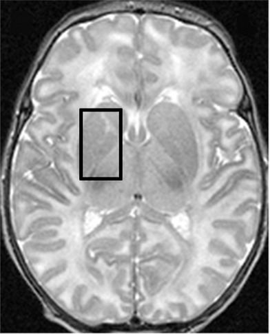 Figure 4a: