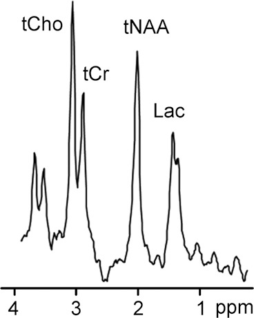 Figure 4b: