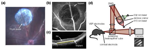 Figure 12