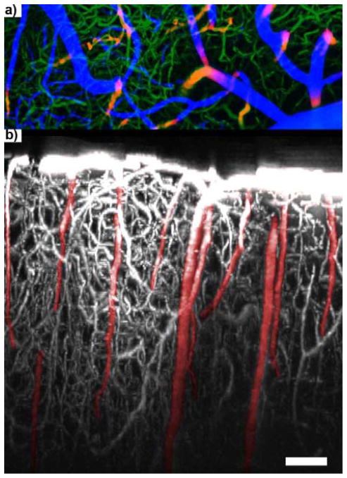 Figure 11