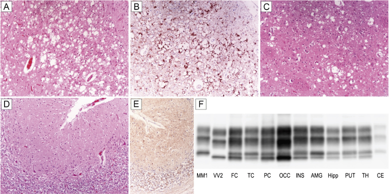 Fig.1