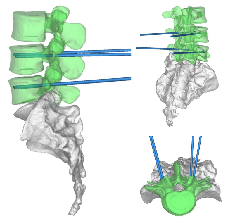 Figure 4