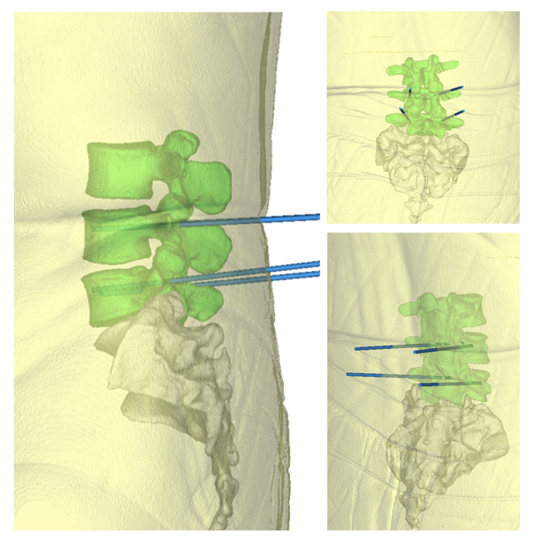 Figure 5