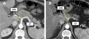 Fig. 12