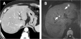 Fig. 10