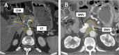 Fig. 13