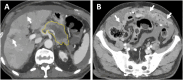 Fig. 11