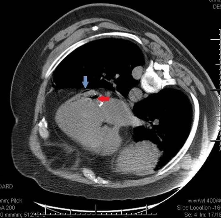 Figure 4