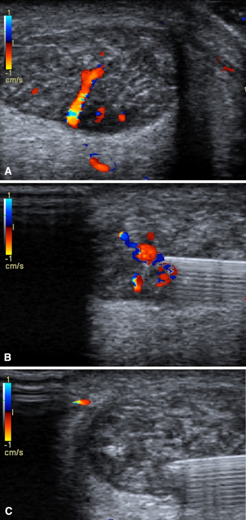 Fig. 3A–C