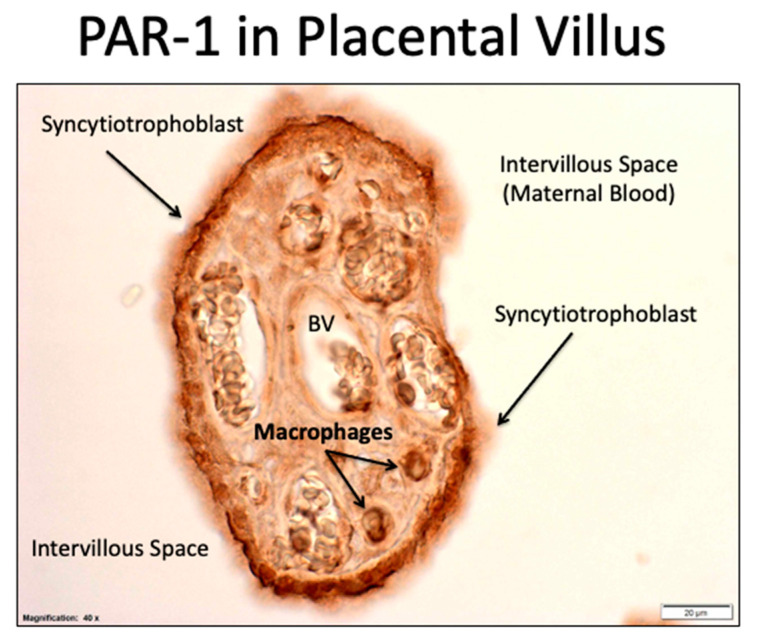 Figure 16