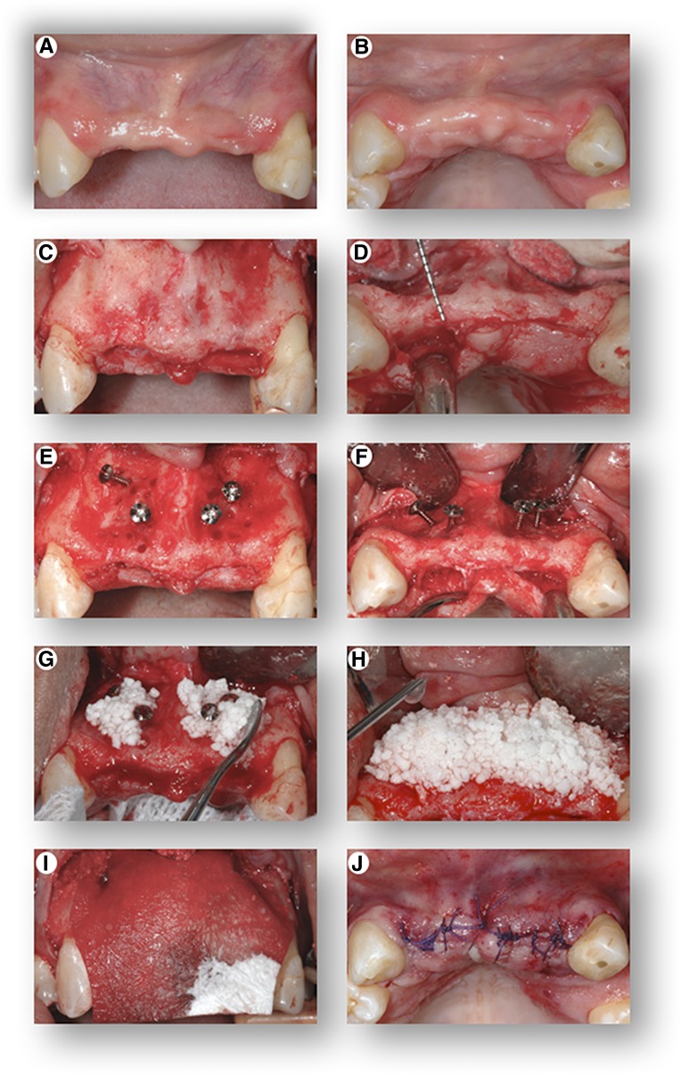 Figure 3.