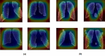 Fig. 13