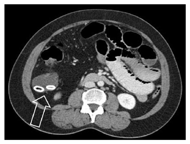 Figure 20