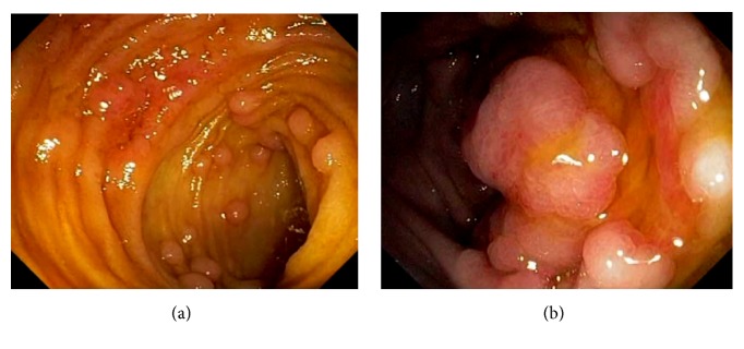 Figure 26