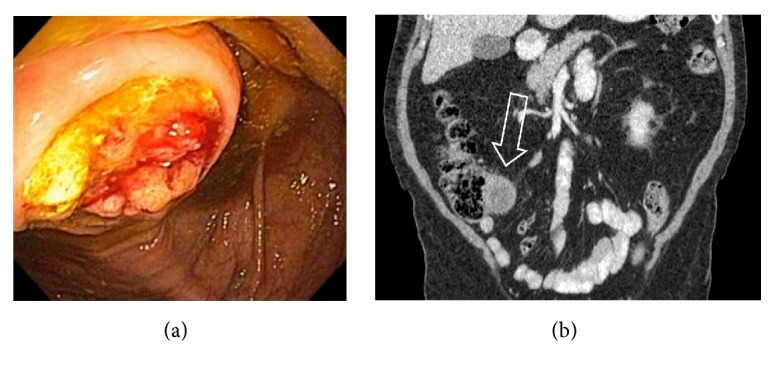 Figure 41