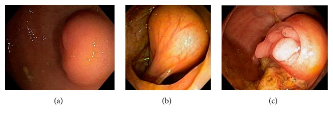 Figure 39