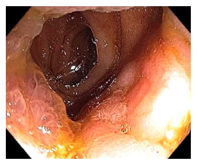 Figure 35