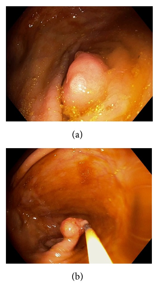 Figure 42