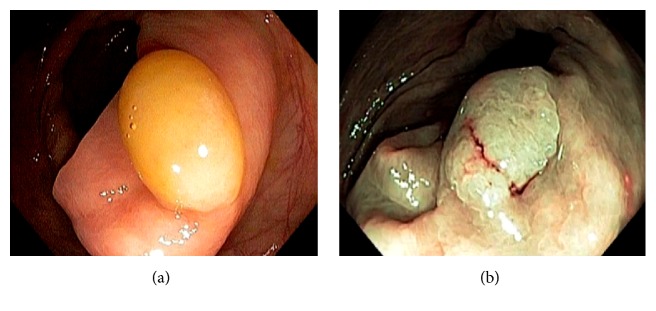 Figure 37