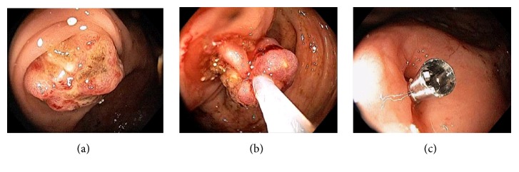 Figure 38